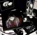 VALKYRJA: Contamination